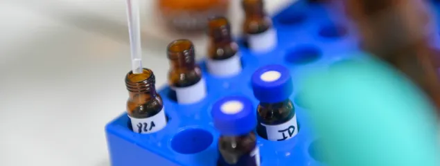 Anaemia & Iron Deficiency