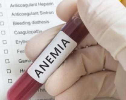anemia